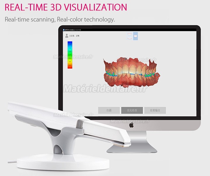 Runyes 3DS scanners intraoral dentaire en sans poudre